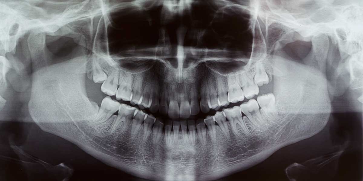 X - Ray Image